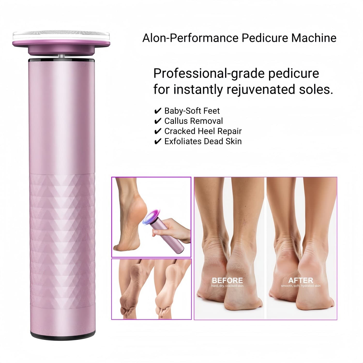 2025 Private Mold Cross-border New Electric Foot Grinder for Callus and Dead Skin Removal, Foot Care Tool