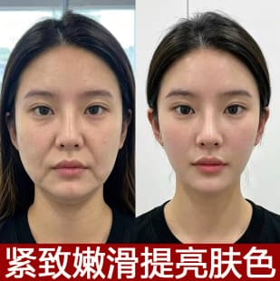 Retinol Face Cream, Vitamin A Alcohol, High Moisture, Nourishing, Anti-Wrinkle Cream, Lifting, Firming, Anti-Aging Repair Face Cream