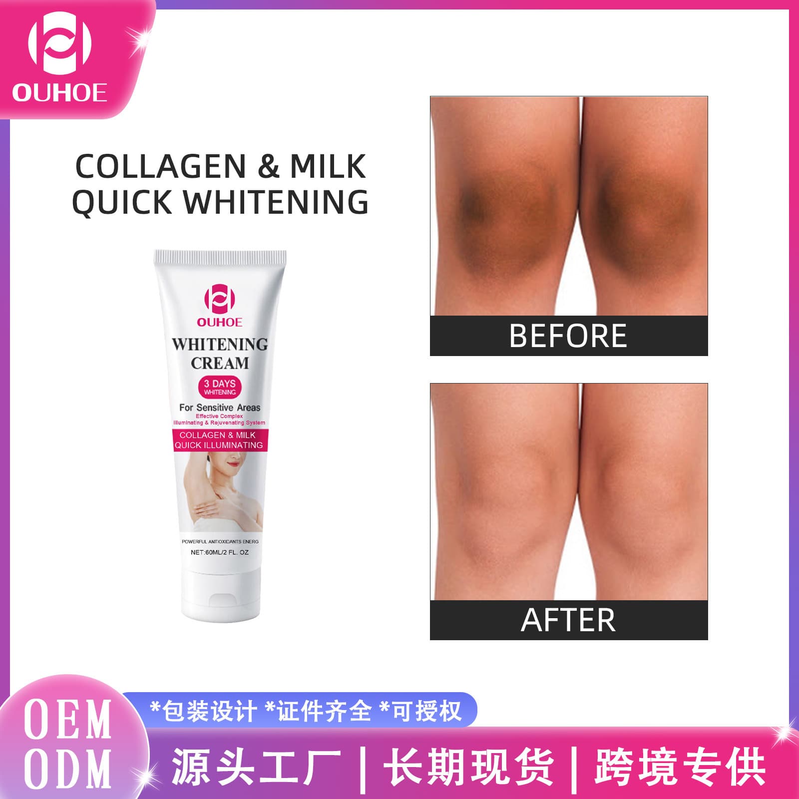 OUHOE armpit body cream, elbow and knee joint private parts skin rejuvenating and smoothing cream