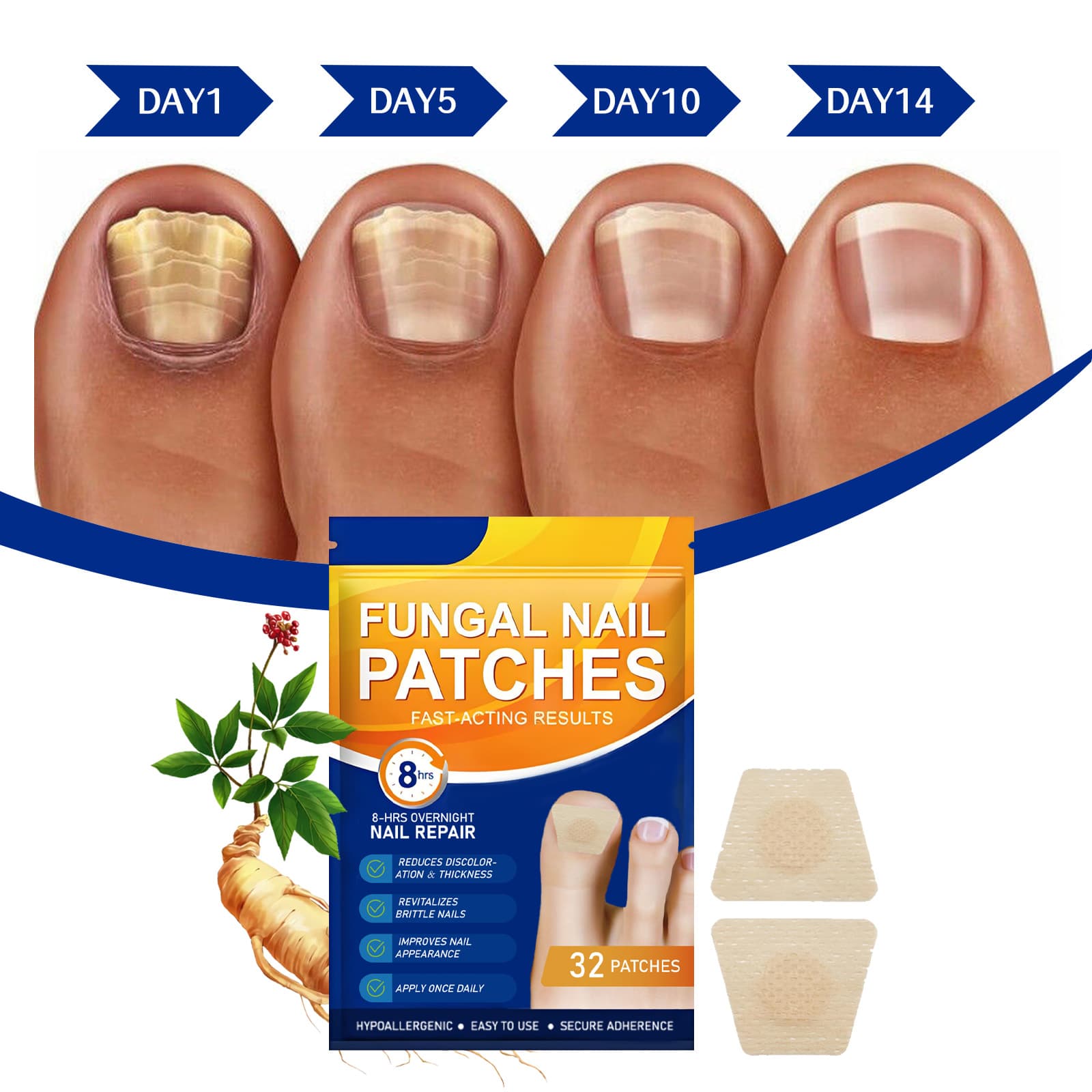 Cross-border Antibacterial Nail Stickers Patches No Glue Required for Ingrown Nails, Fungal Nails, Nail Damage
