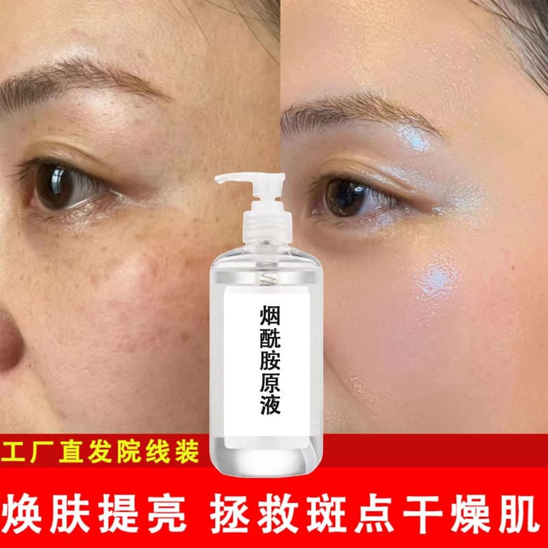 Niacinamide original solution 10% high concentration improves dull yellowing, blackening, brightens skin tone, oil control and moisturizing Niacinamide Essence
