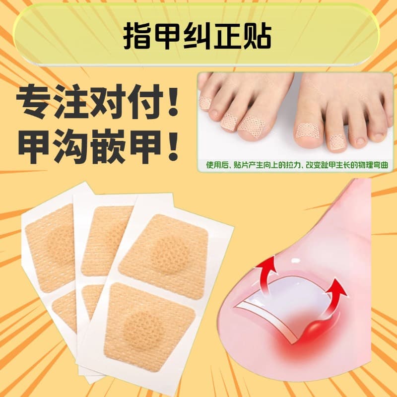 Cross-border nail care patches, ingrown toenail patches, toe pad protectors, soft nails, and orthopedic nail patches.