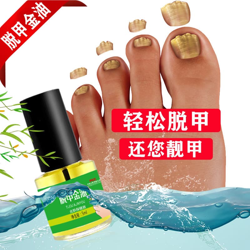 Factory Wholesale Nail Fungus Treatment Liquid, Nail Removal Cream, Nail Removal Liquid, Cross-border Nail Fungus Liquid, Nail Repair Liquid, Nail Fungus Liquid