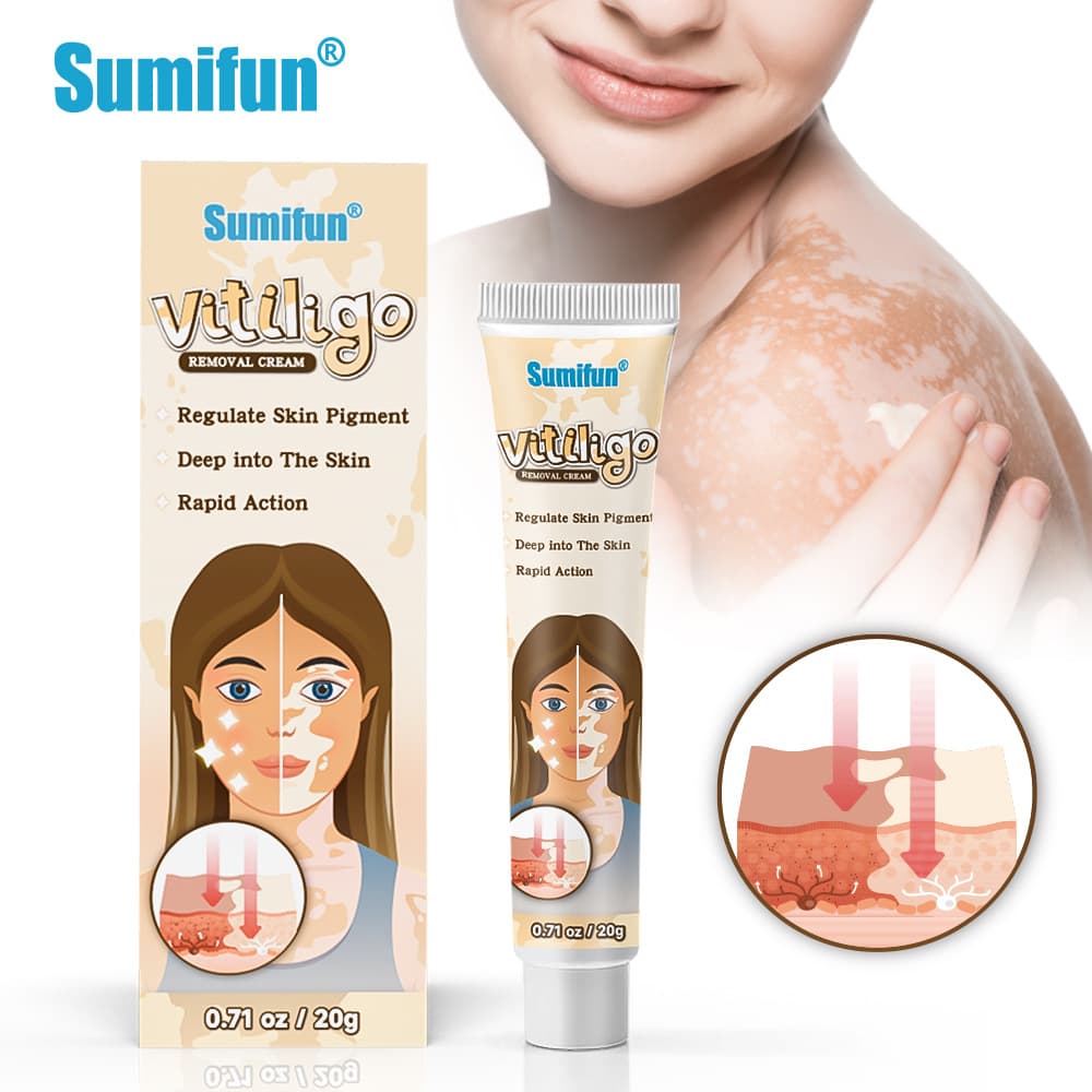 Sumifun Amazon Cross-Border Ointment White Spot Care Cream Tinea Versicolor Care Cream Skin External Use Wholesale