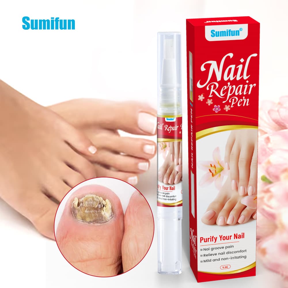 Sumifun Russian Amazon Cross-Border Nail Care Solution Onychomycosis Black Nail Care Health Cream K60016