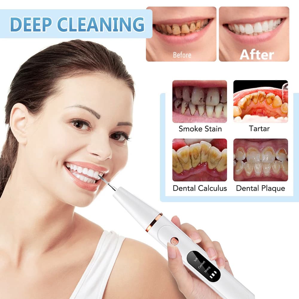 Cross-border new ultrasonic dental scaler with LED light, multi-functional replacement heads, three-speed settings, Russian version