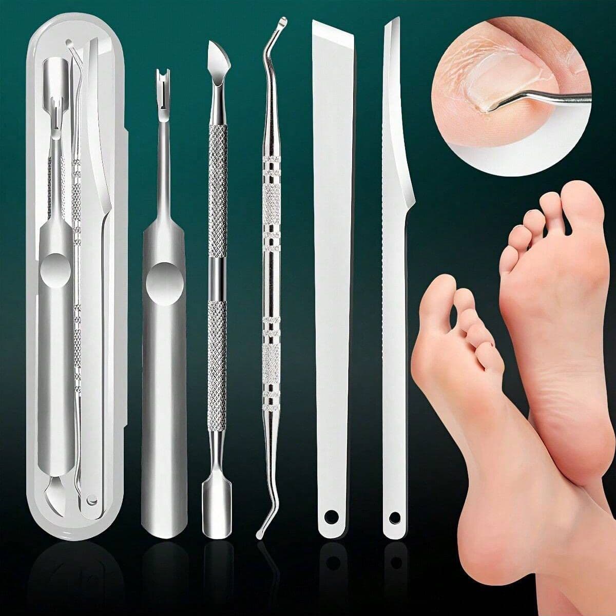 Stainless Steel Pedicure Tool Set - Ingrown Toenail Spoon, Nail Growing into Flesh, Thick Toenail Lifter, Curved Nail Corrector