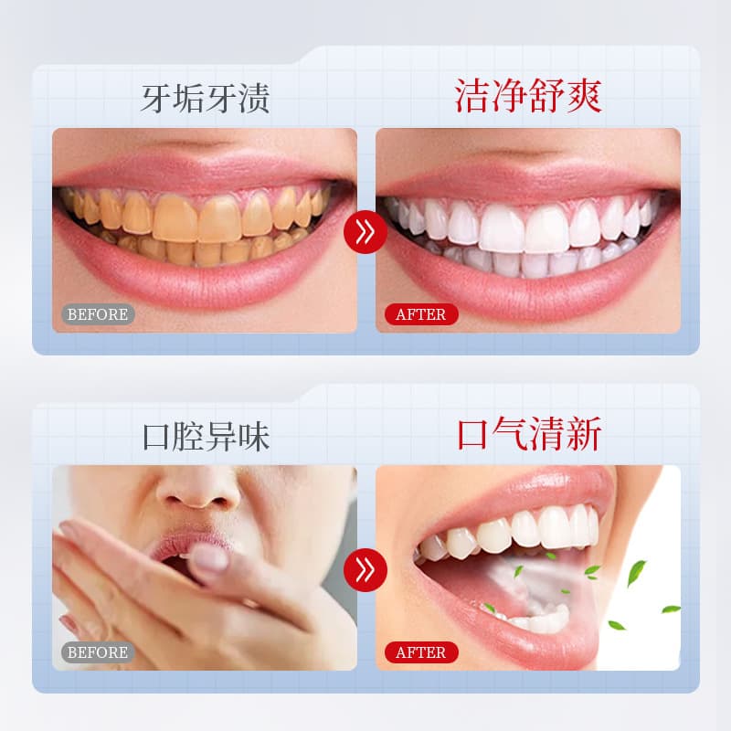 Dentist Dental Separator Toothpaste Deep Clean Fresh Breath Clean Teeth Protect Gums Gentle Cleaning Toothpaste Wholesale