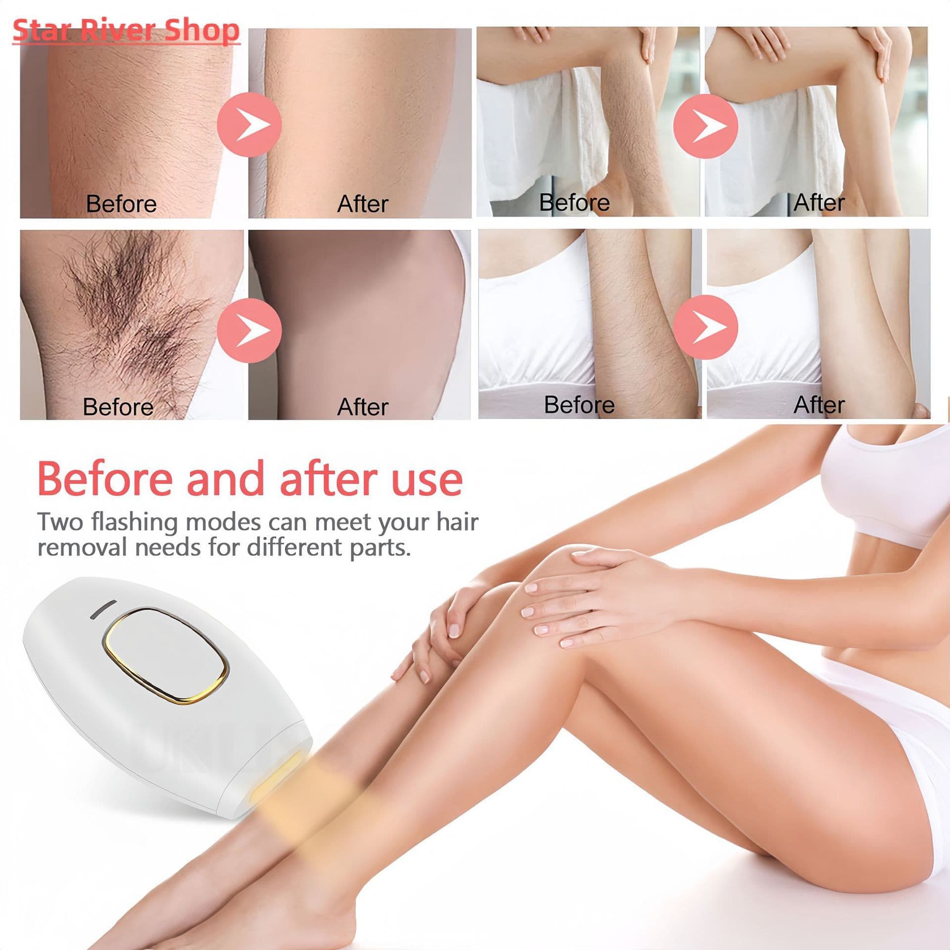 Home Painless Laser Hair Removal Device, Hot-Selling Export Model, Portable Full-Body Use, Factory Direct
