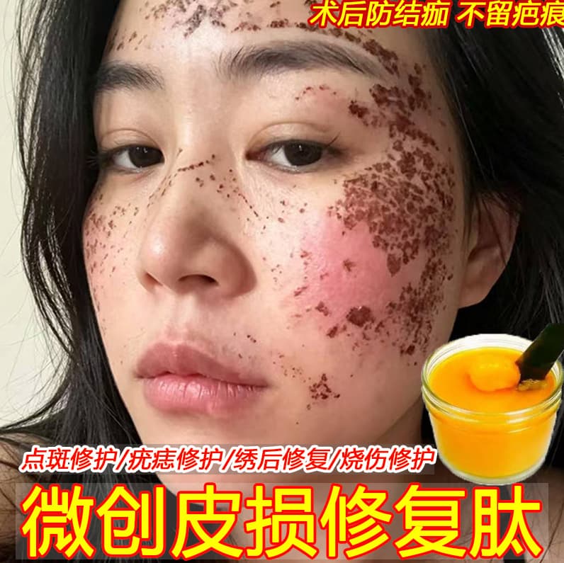 Beauty salon repair factor repair cream, spot nevus cream, microneedle post-surgery skin breakage, burns, sunburn repair peptide essence