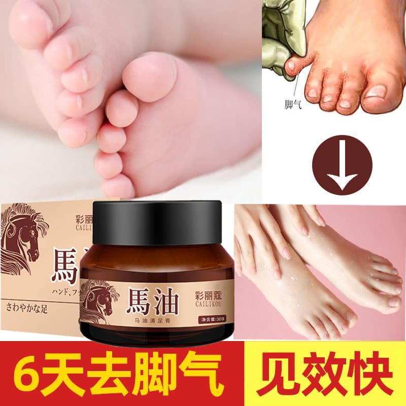 Japanese Horse Oil Athlete's Foot Cream, Fast-Acting for Foot Odor, Itching, Sweating, Cracking, and Chapped Feet, Anti-Crack and Anti-Frost Cream
