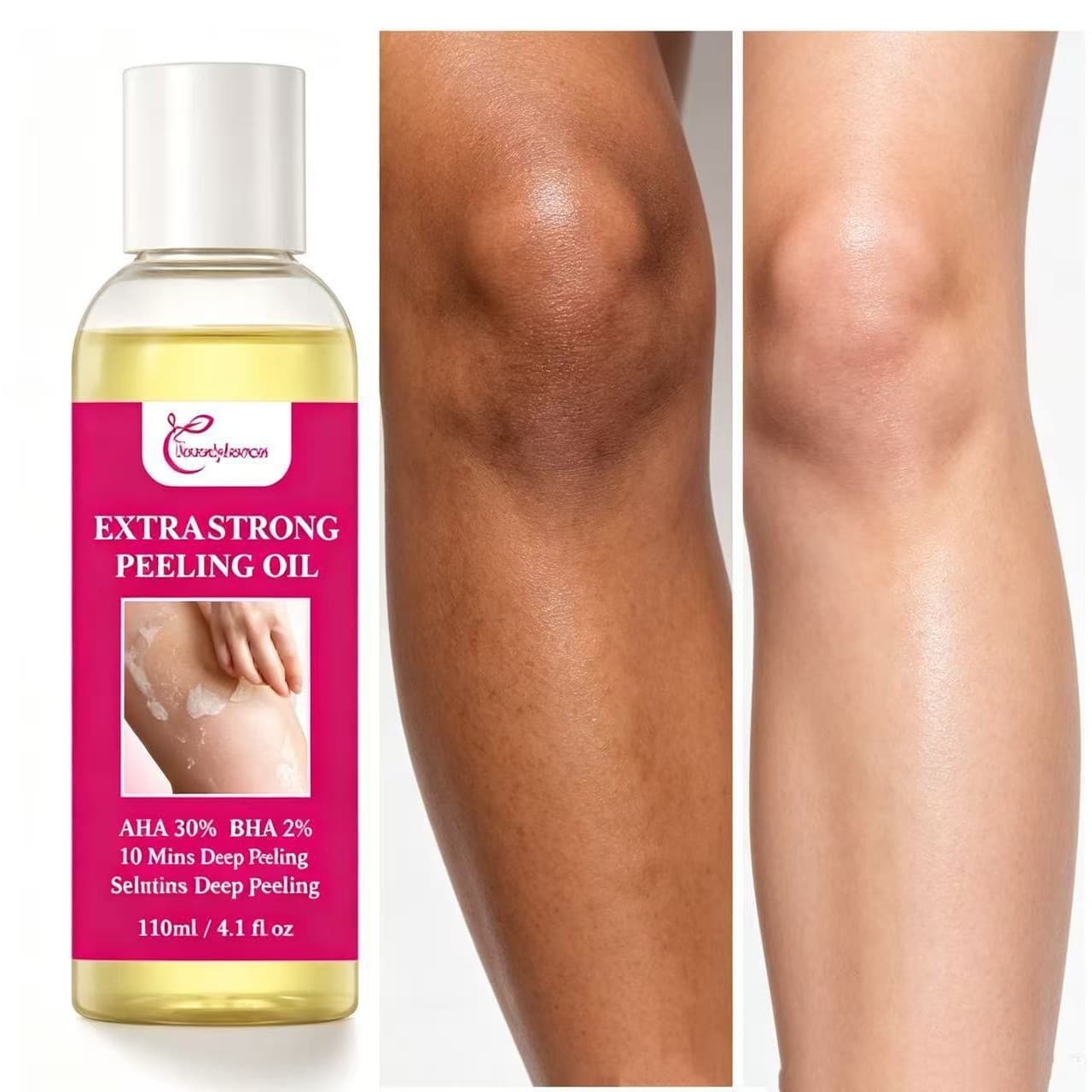 Cross-border Peeling Oil AHA+BHA Exfoliating Oil for Joints Dark Spot Peel-Off Exfoliator Yellow Skin Peeling Oil