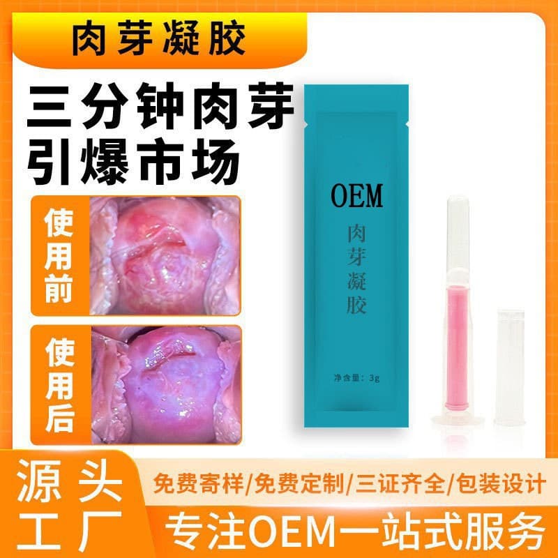 Granulation gel treatment, female intimate care maintenance, vaginal mucosa, granulation growth, intimate gynecological antibacterial gel