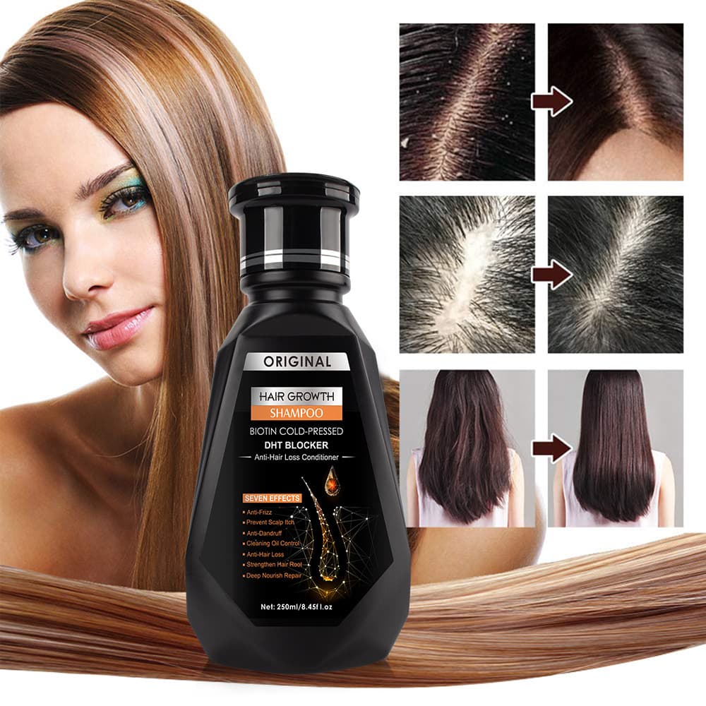 Cross-border Ginger Shampoo, Hair Cleansing, Hair Strengthening, Hair Care, New Version, Wholesale, Hair Growth Shampoo