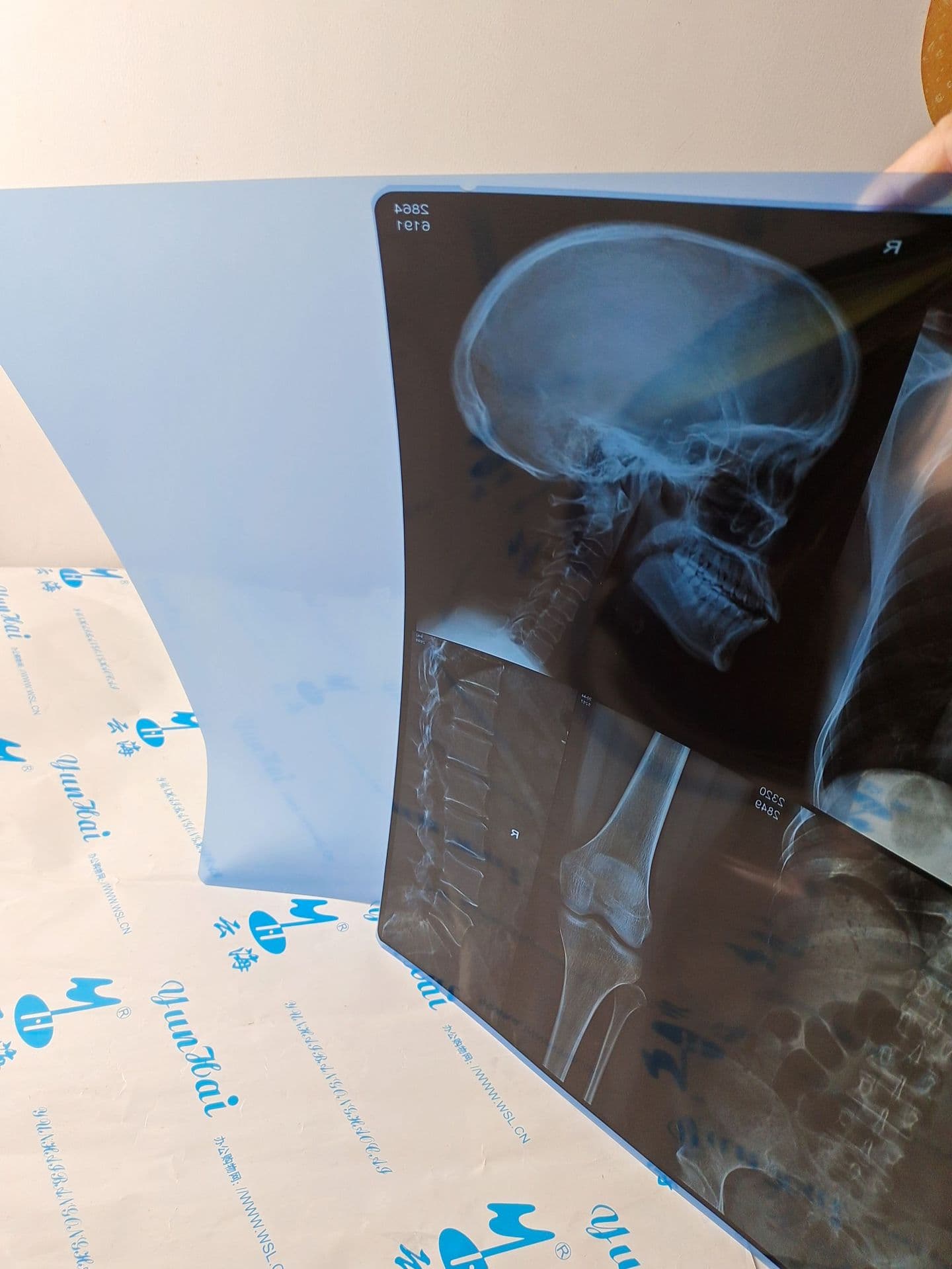 14x17 Blue Base Blue Thermal Film for CT, CR, DR, MRI, Nuclear Magnetic Resonance, Radiology Medical Film, Yunhai