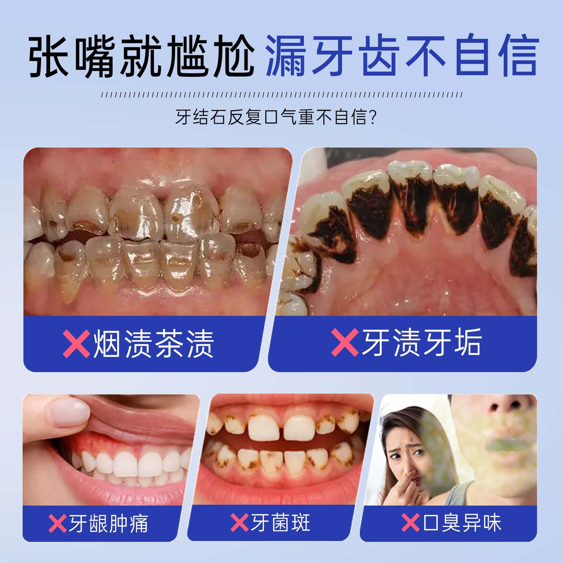 Hong Kong Tartar Spray for Removing Smoke Stains, Plaque, and Bad Breath, Tartar and Plaque Remover