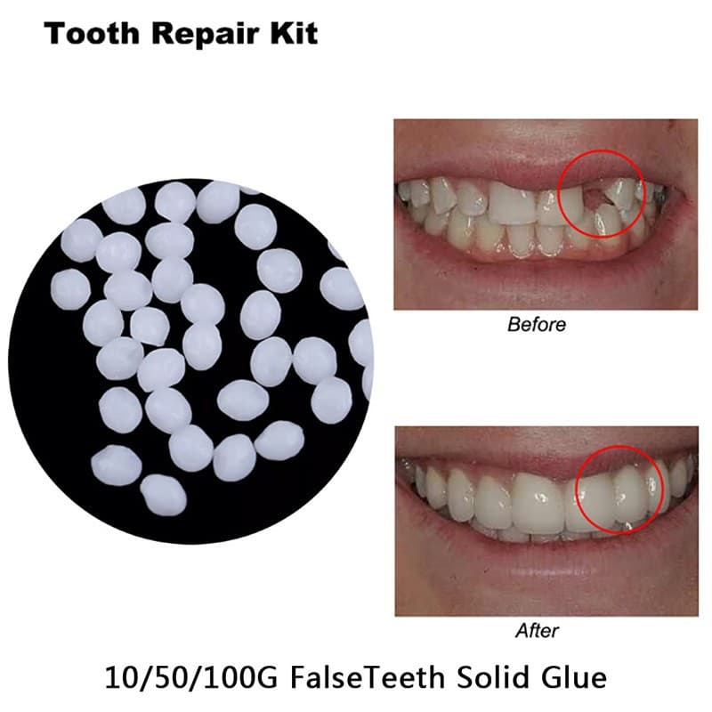 Manufacturer Wholesale Solid Teether Film and Television Makeup Denture Modification Temporary Filling Teether Tooth Cavity Filling Teether
