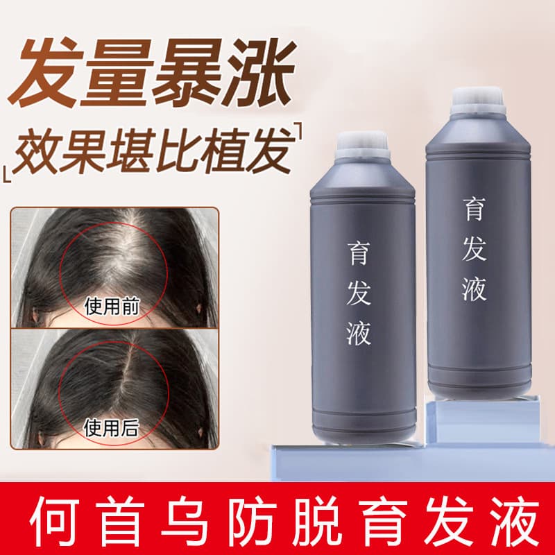 Herbal Hair Growth Serum, Thickening & Anti-Hair Loss Nutrient Solution, Repair Hair Roots, Nourish Scalp, Hair Care Liquid