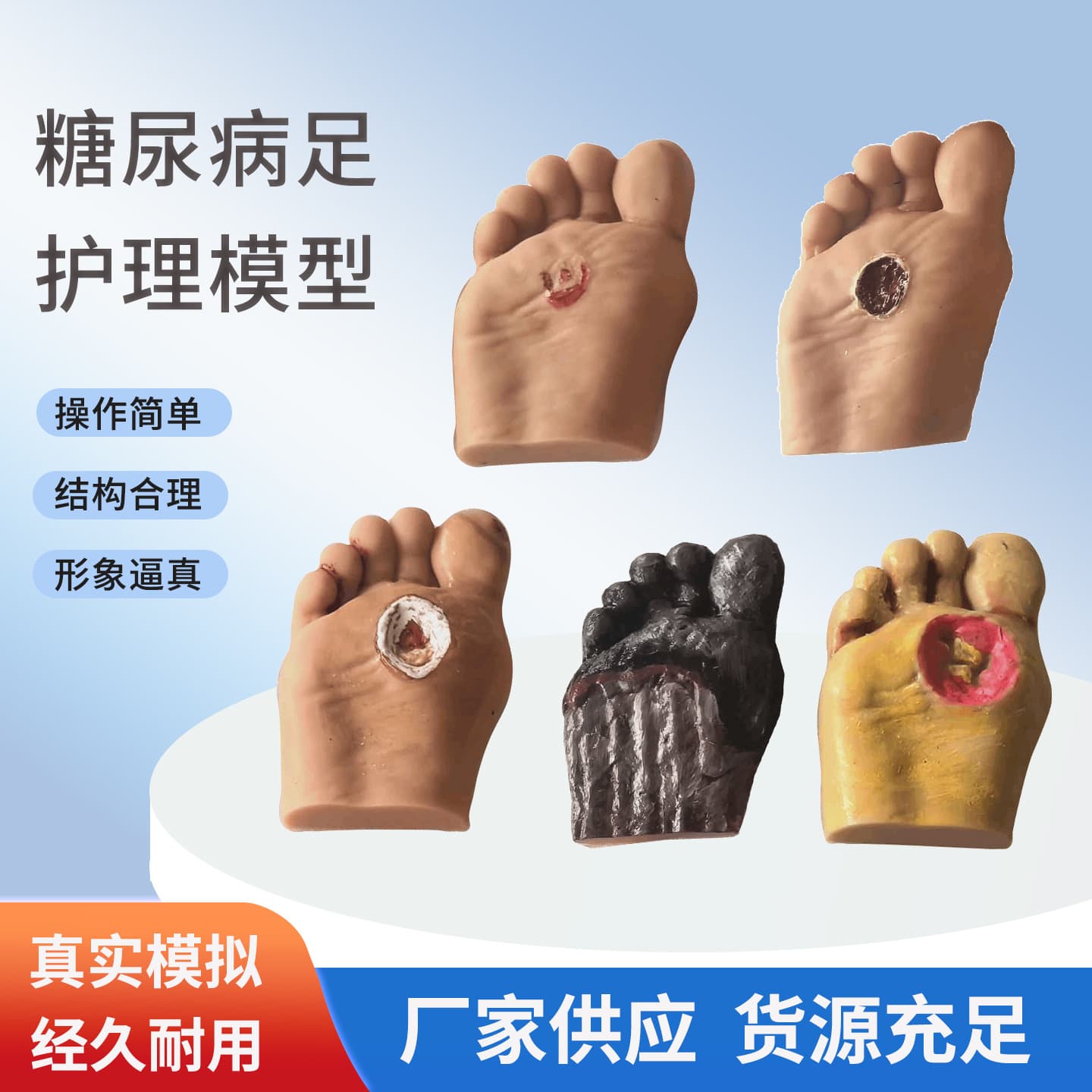 Diabetic Foot Lesion Model Wound Foot Model for Ulcer Care Teaching Lesion Care