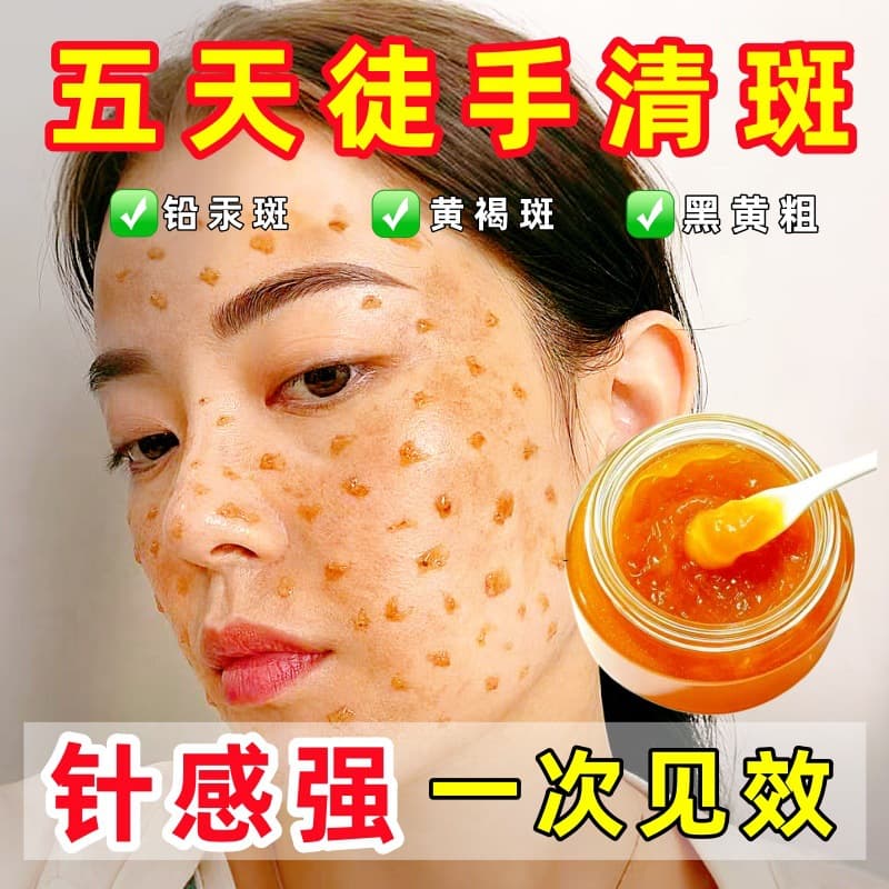 Seed Diamond Microneedle Freckle Cream Beauty Salon Model Seed Diamond Microneedle Freckle Cream Seed Diamond Microneedle Freckle Cream