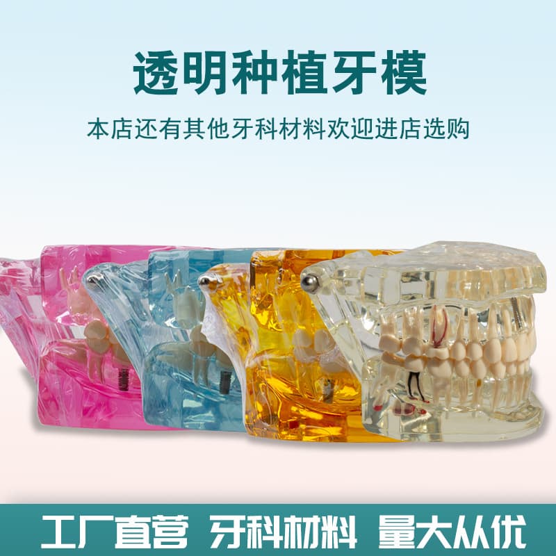 Dental Implant Demonstration Model Oral Teaching Model Doctor-Patient Communication Model Comprehensive Model Removable Teeth Model