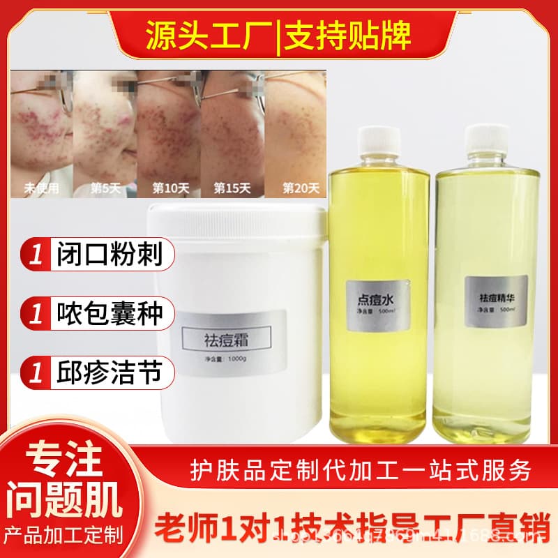 Acne Spot Treatment Water, Anti-Acne Essence, Non-Prescription Herbal Acne Cream, Hospital-Grade Product for Acne, Closed Comedones, and Acne Marks