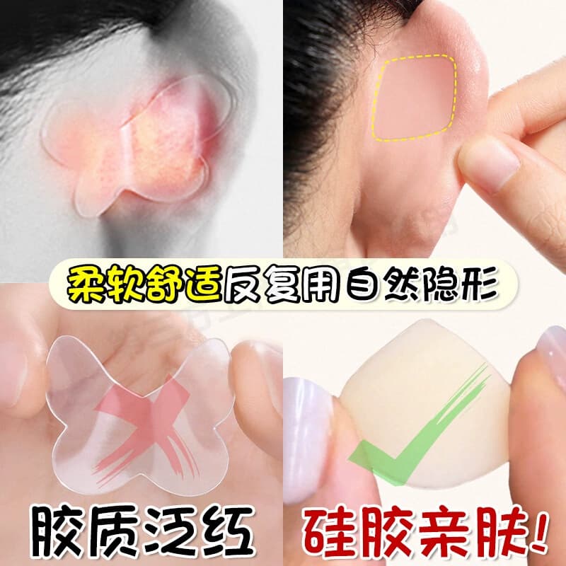 Chip Elf Ear Patch heterosexual ear ear patch support veneer to correct erect ears invisible face keel support