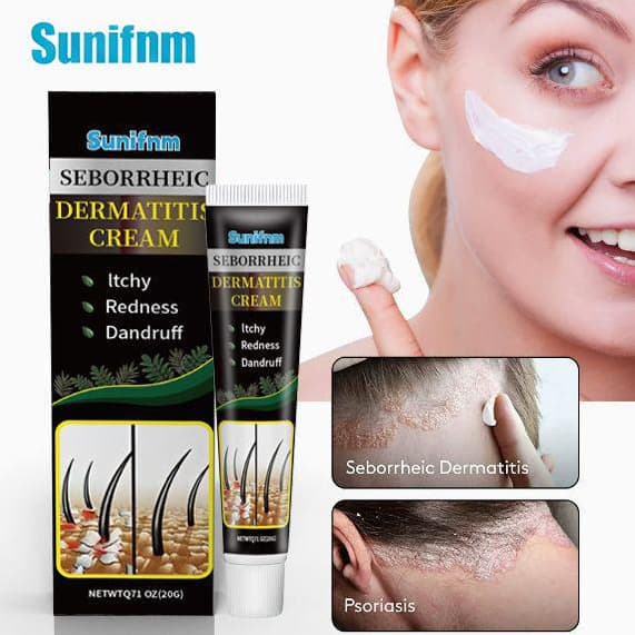 Sunifnm Cross-Border Amazon Foreign Trade Itching Cream Head Care Dermatitis Seborrheic Scalp Ringworm Health Care Cream