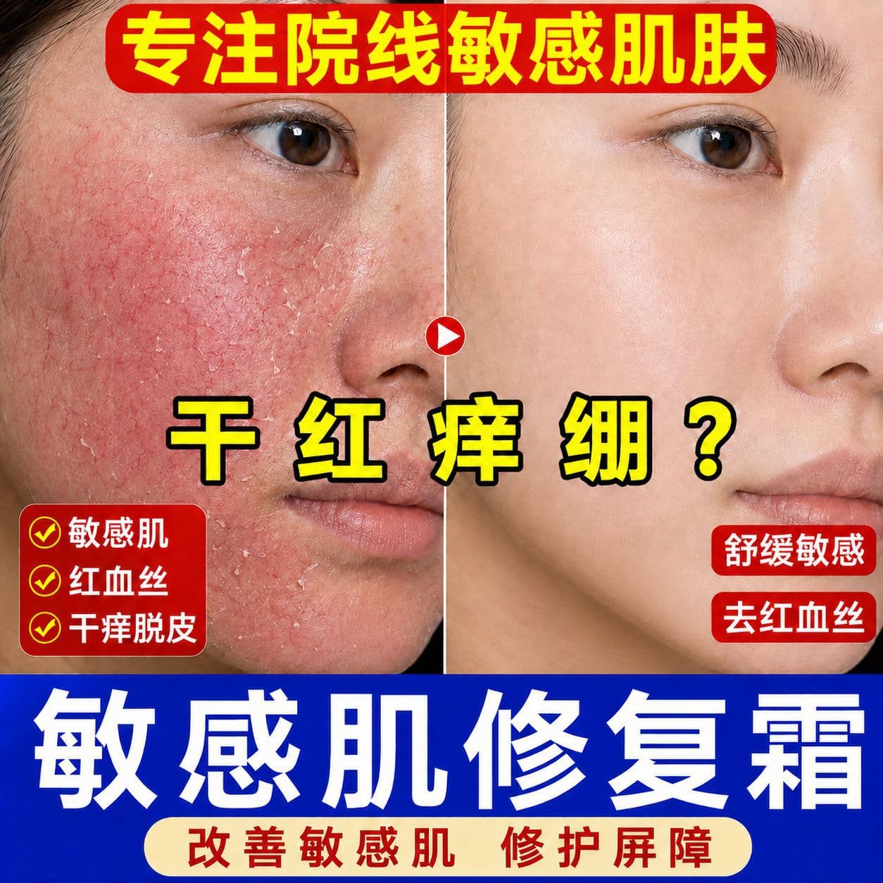 Centella Asiatica Repair Cream - Reduces Redness, Soothes, Repairs Sensitive Skin, Hydrates, Thickens Corneal Layer, Hormonal Face Repair Cream