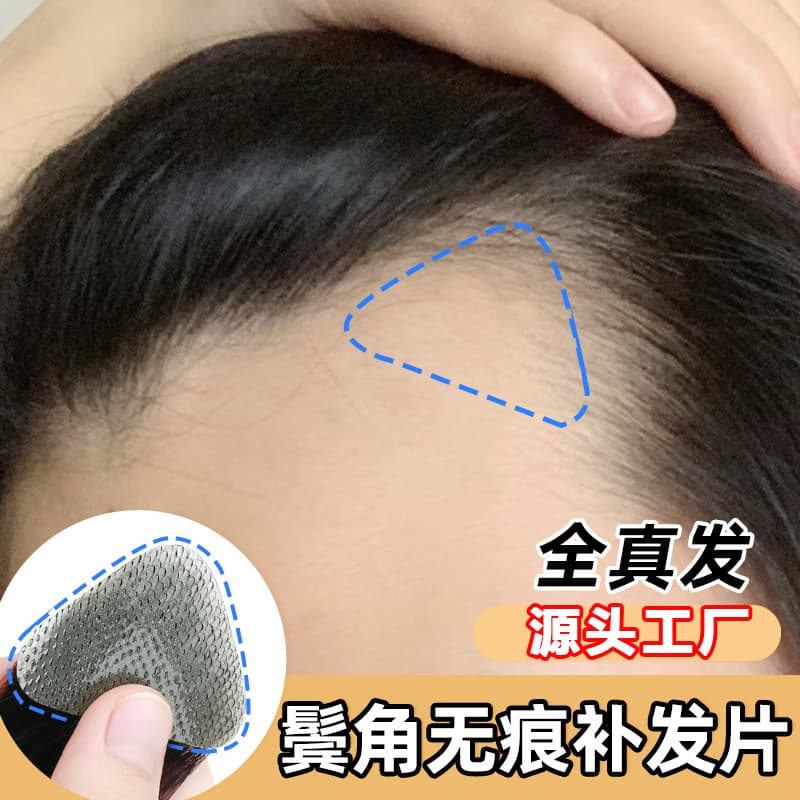 Hairline Wig Patch for Men and Women, Real Hair Temple Wig, Hair Replacement Piece for Forehead, M-Shaped Hairline Cover