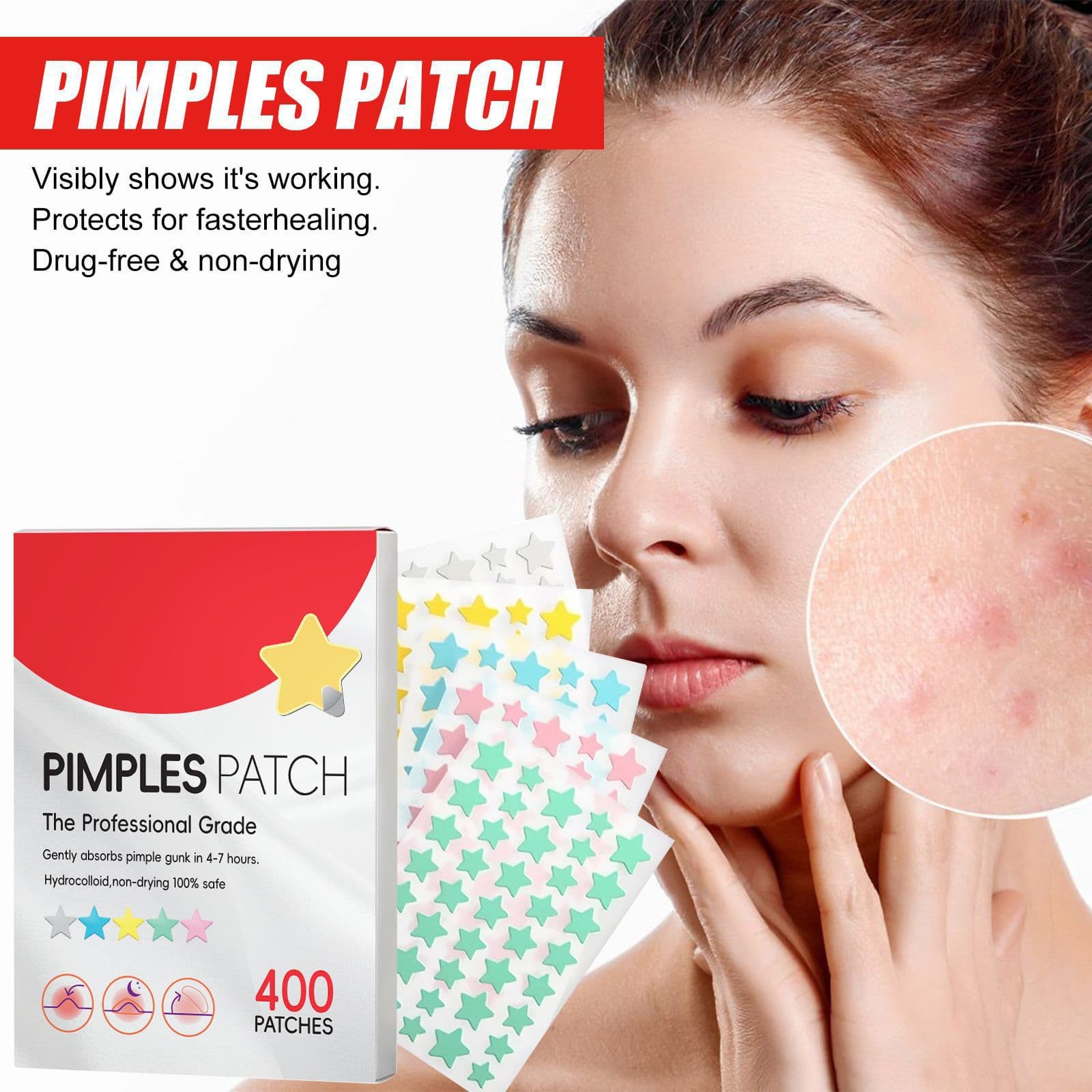 Cross-border acne patch covering pimples acne patch repair skin acne marks pits blemishes fade acne patch in stock