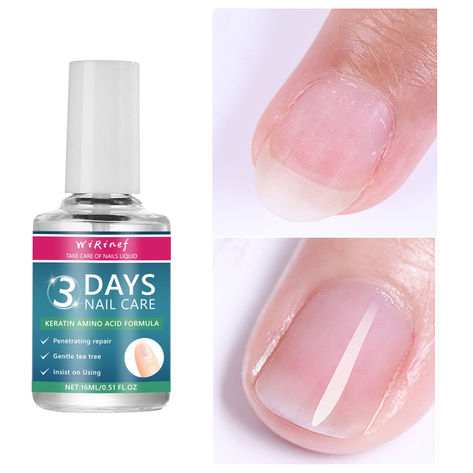 Cross-border Bestseller 3 Days Nail Care Nail Brightening Care Liquid Nourishing Moisturizing Care 3-Day Nail Liquid