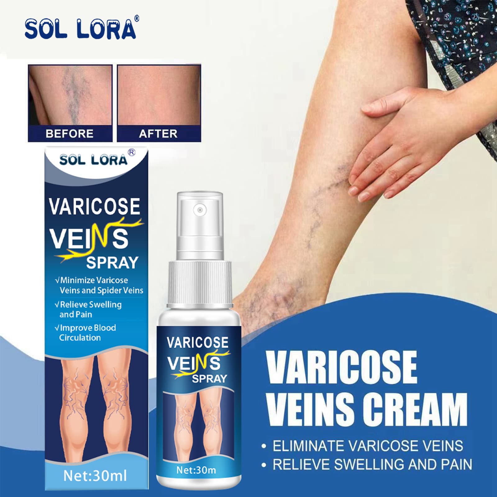 SOL LORA Amazon Cross-Border Varicose Vein Spray Blue Vein Relief Ointment Spray