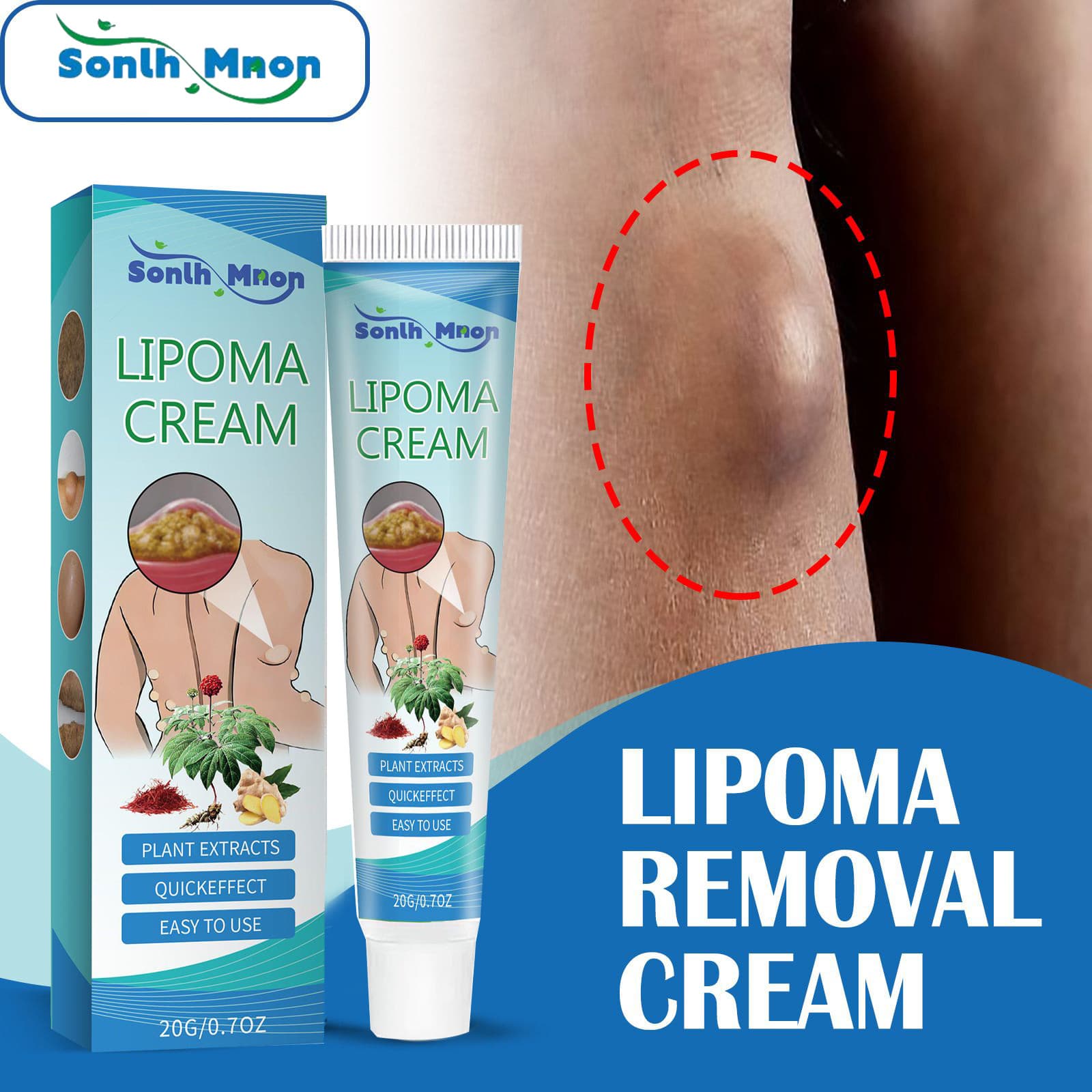 Cross-border Sonlh Mnon Fat Lump Cream, Relieves Fat Lumps and Subcutaneous Masses, Body Care Cream for Smoothing