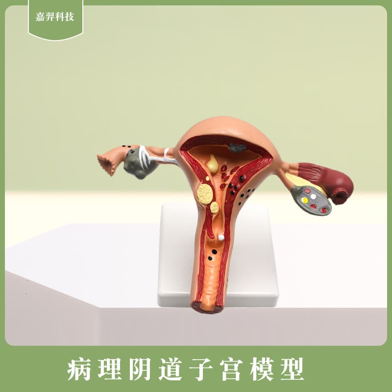 Pathological Uterine Model Vagina Ovarian Anatomy Medical Simulation Female Reproductive Simulation Human Uterus Model Teaching Aids