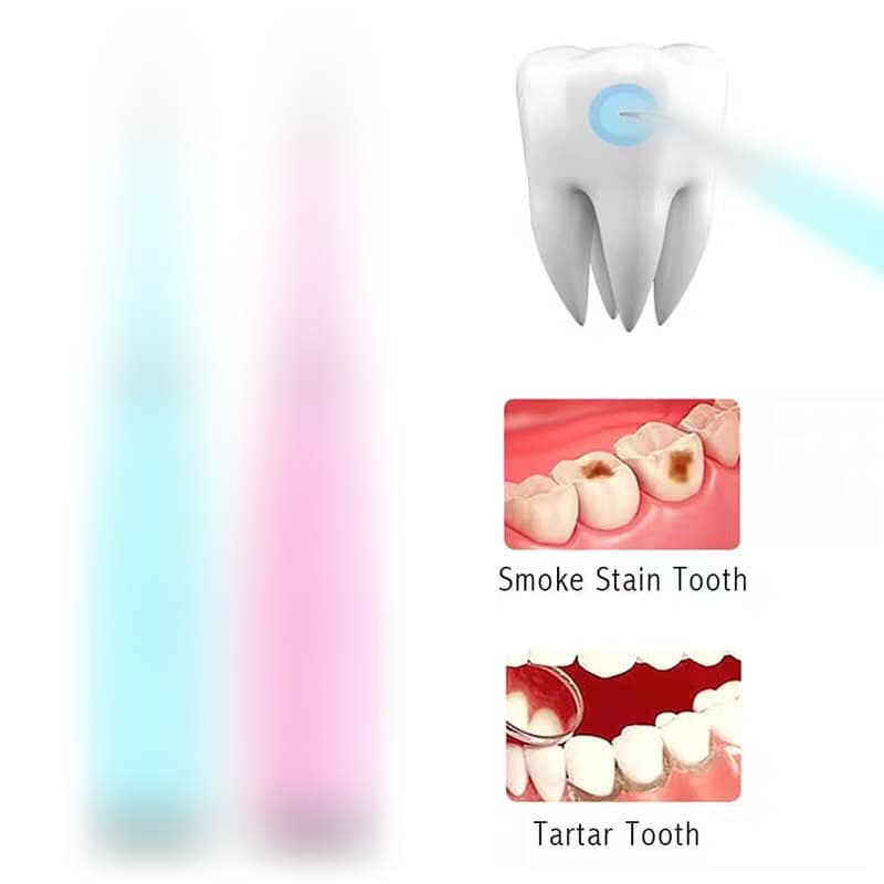 Cross-Border Electric Dental Scaler, Tartar Remover, Oral Care Tool, Multifunctional Ultrasonic Teeth Whitening Device