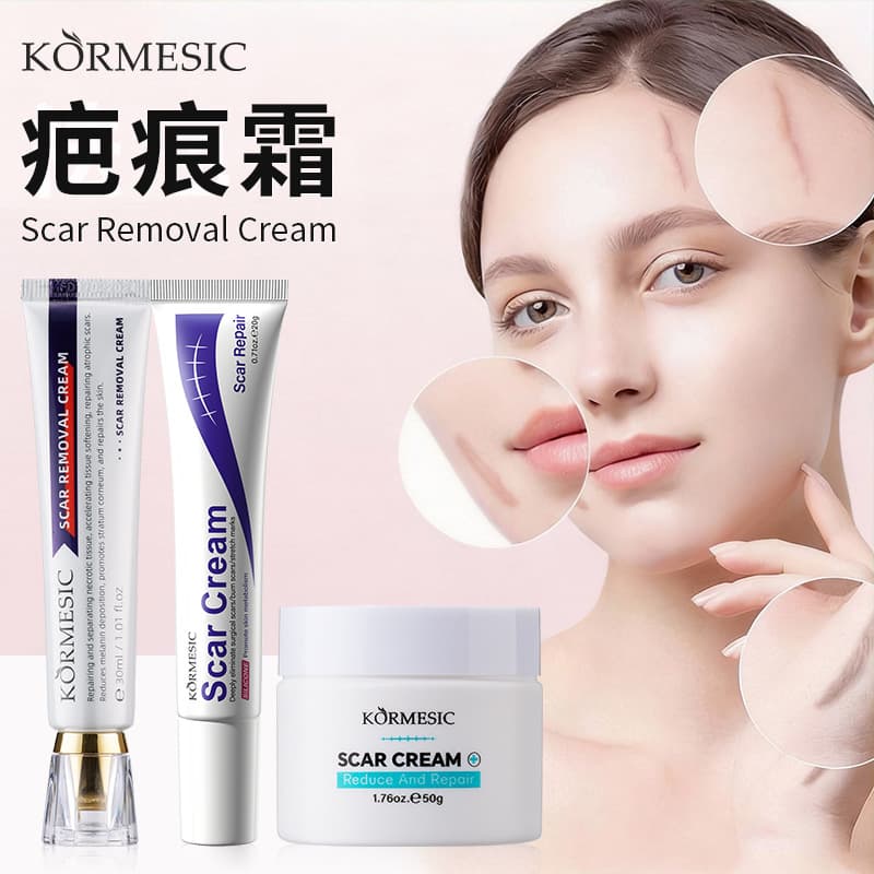 Amazon Best-Selling Scar Removal Cream for Skin Repair KORMESIC Scar Removing Cream