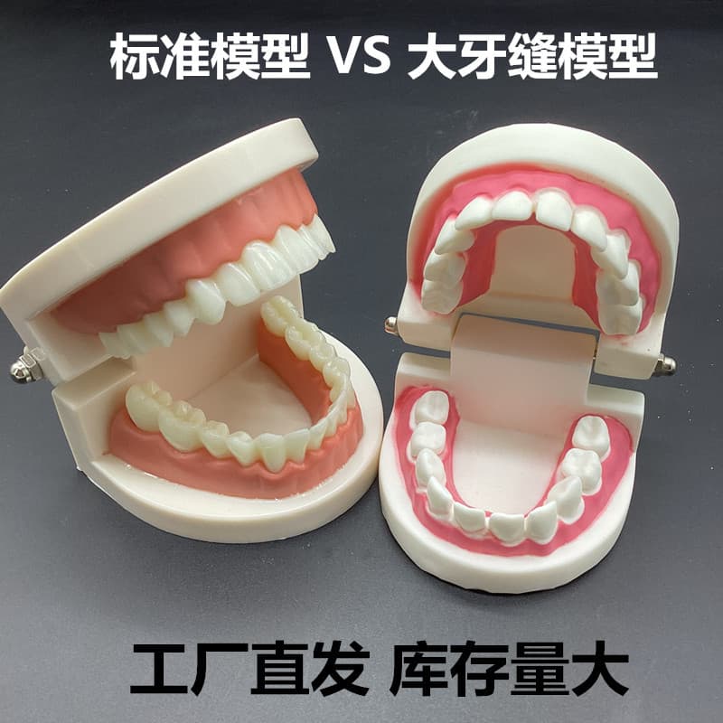 Dental Teeth Model for Student Practice Teaching Mold Orthodontic Model Standard Large Gap Model