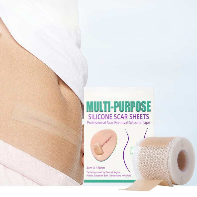 Silicone Gel Scar Concealment Patch, Lightening Silicone Gel Skin Patch, Gel Scar Patch, Skin Patch 4*