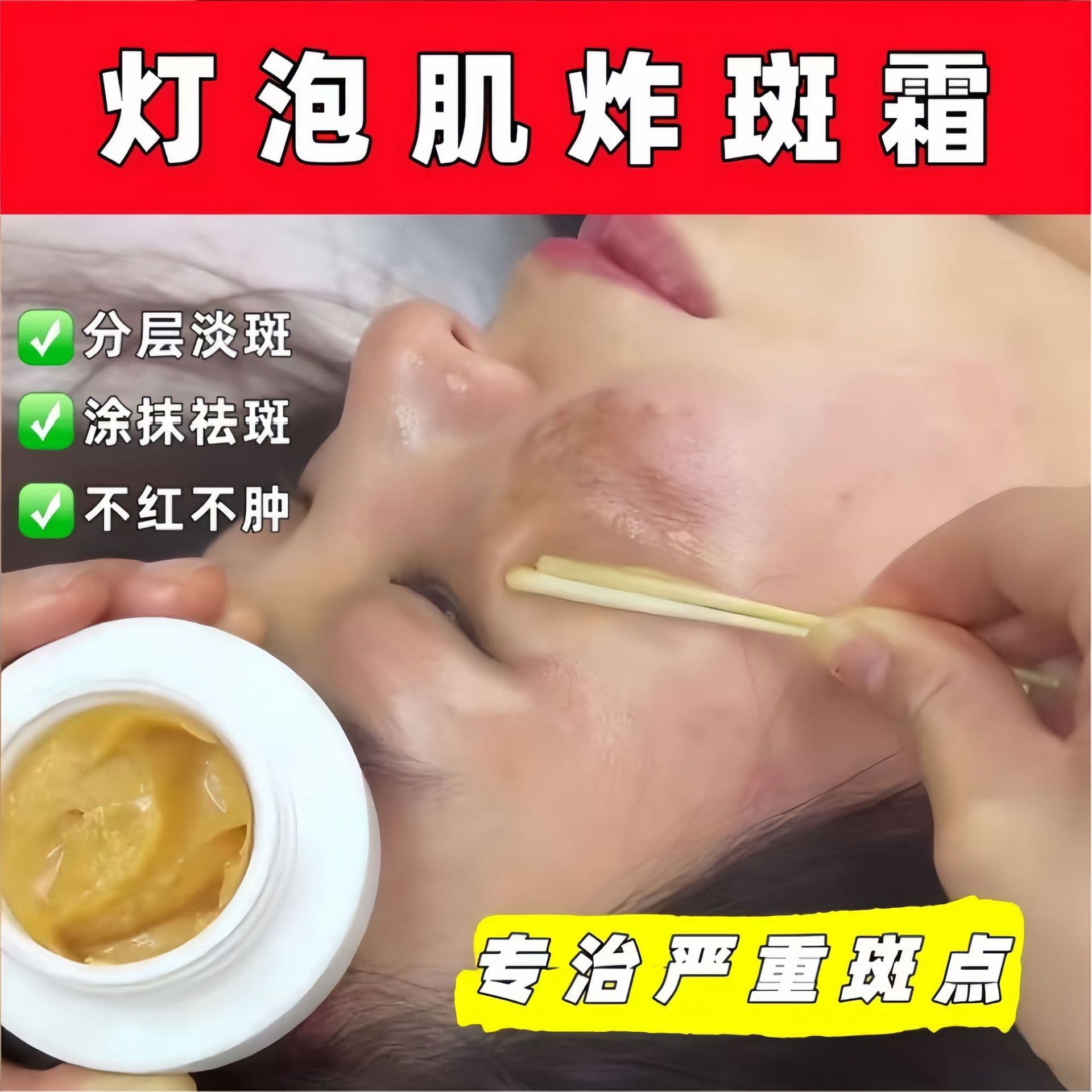 Special Edition Lightbulb Skin Spot-Cracking Cream, non-reddening, non-swelling, non-peeling, gentle spot removal, non-irritating, no embarrassment spot removal cream